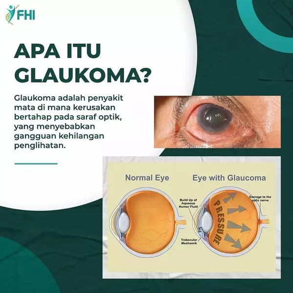 AnyConv.com__Konten FHI Flvnol Terbaru 57 (2)